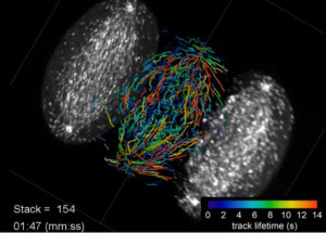 Growing microtubule endpoints and tracks are color coded by growth phase lifetime.Credit: Betzig Lab, HHMI/Janelia Research Campus, Mimori-Kiyosue Lab, RIKEN Center for Developmental Biology 