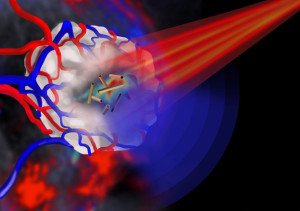 The nanotubes can be tumor-targeted and have a central 'hollow' core that can be loaded with a therapeutic payload.Image: Jing Claussen (iThera Medical, Germany)