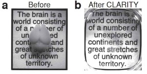 A mouse brain before and after it's been made transparent using CLARITY.Image: Kwanghun Chung and Karl Deisseroth, Howard Hughes Medical Institute/Stanford University