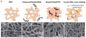Blood clots treated with PolySTAT (second from right) had denser fibrin networks, which helps reinforce and strengthen the clots.Image: University of Washington